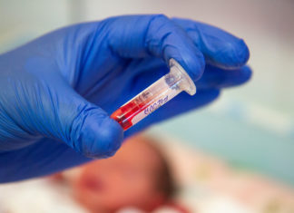 screening neonatale