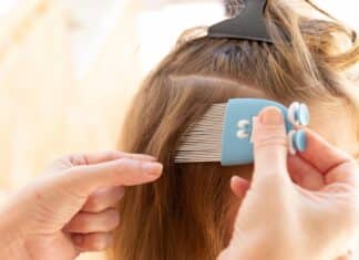 Occhio ai pidocchi (e agli antipidocchi): il test su 7 trattamenti