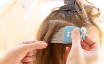 Occhio ai pidocchi (e agli antipidocchi): il test su 7 trattamenti