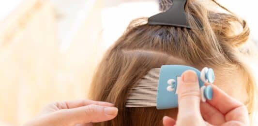 Occhio ai pidocchi (e agli antipidocchi): il test su 7 trattamenti