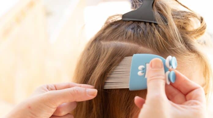 Occhio ai pidocchi (e agli antipidocchi): il test su 7 trattamenti