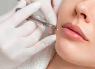 Filler, il ministero alle farmacie: vendita consentita solo ai professionisti filler