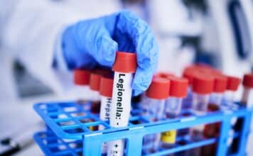 Legionella in aumento: oltre 10 casi al giorno in Italia nel 2024 LEGIONELLA