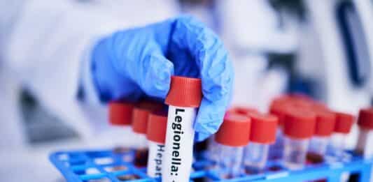 Legionella in aumento: oltre 10 casi al giorno in Italia nel 2024 LEGIONELLA
