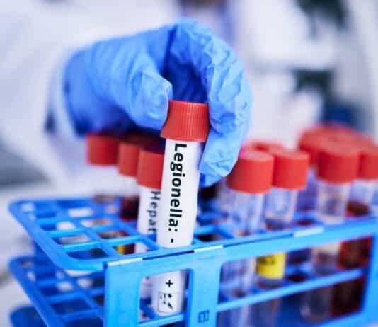 Legionella in aumento: oltre 10 casi al giorno in Italia nel 2024 LEGIONELLA