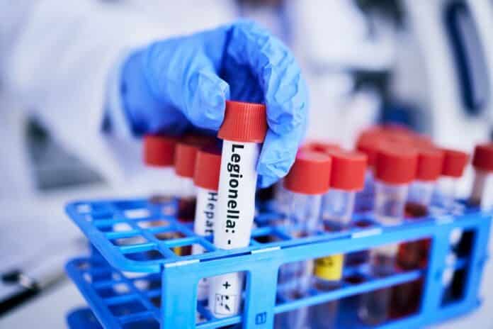 Scientist, hand and bacteria sample in test tube, person in lab with medical research and healthcare study. Doctor, gloves and vaccine, check legionella sample closeup and scientific experiment LEGIONELLA