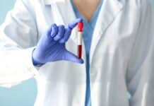 Pfas nel sangue degli europeo: trovato Tfa nel 100% dei campioni pfas sangue