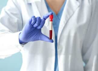 Pfas nel sangue degli europei: trovato Tfa nel 100% dei campioni pfas sangue