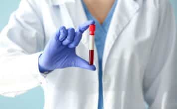 Pfas nel sangue degli europei: trovato Tfa nel 100% dei campioni pfas sangue